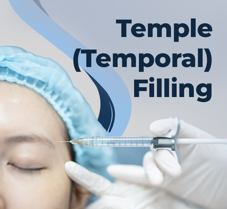 Temporal Filling